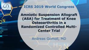 Amniotic Suspension Allograft (ASA) for Treatment of Knee Osteoarthritis in a Randomized Controlled Multi-Center Trial