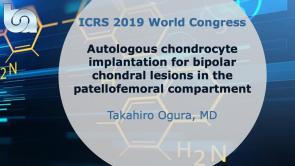 Autologous chondrocyte implantation for bipolar chondral lesions in the patellofemoral compartment